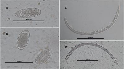 Comparison of Molecular and Parasitological Methods for Diagnosis of Human Trichostrongylosis